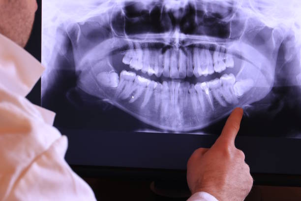 Best Emergency Gum Pain Relief  in Poway, CA